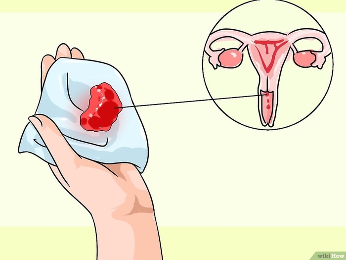 6 căn bệnh nguy hiểm thường gặp ở cổ tử cung, chị em nên lưu ý