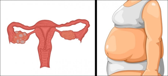 7 bệnh lý về sức khỏe khiến chúng ta không thể nào giảm cân thành công