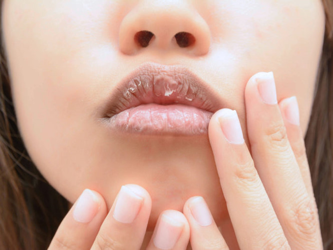 8 dấu hiệu cơ thể cảnh báo bạn đang thiếu vitamin trầm trọng