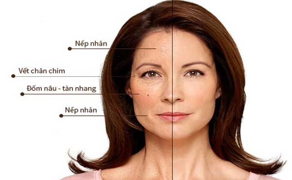 Điều gì đã làm nên thành công của Venesa?