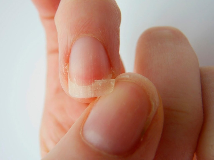 Khi thấy mình có những dấu hiệu này, cần phải bổ sung sắt ngay