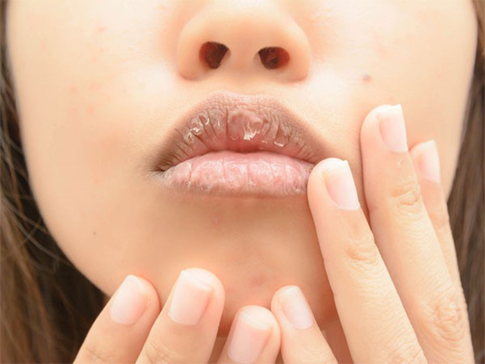 Khi thấy mình có những dấu hiệu này, cần phải bổ sung sắt ngay