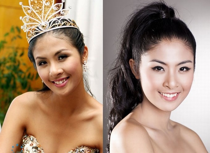 Ngỡ ngàng trước nhan sắc của mỹ nhân Việt trước và sau khi chỉnh răng