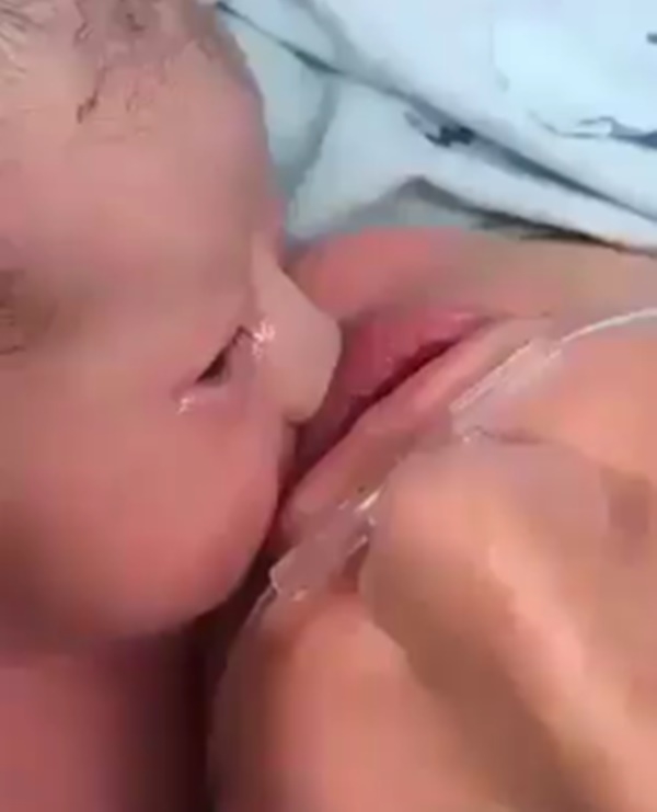 Rơi nước mắt cảnh bé sơ sinh vừa lọt lòng thì đã chia tay mẹ mãi mãi