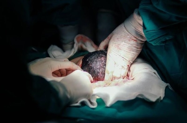 Đừng trách sinh mổ là không biết đẻ, nhìn hình ảnh này mới xót đau