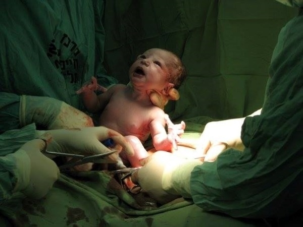 Đừng trách sinh mổ là không biết đẻ, nhìn hình ảnh này mới xót đau