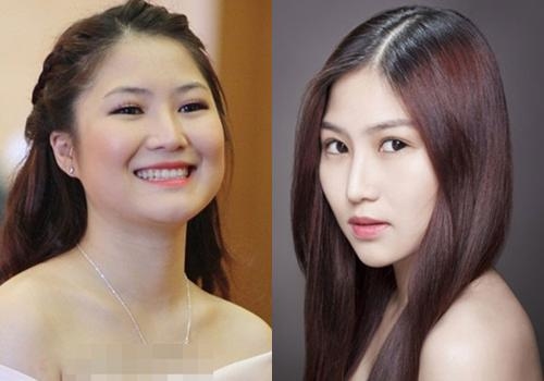 Đâu chỉ mỗi cằm nhọn Vline, sao nữ Vbiz còn thích thẩm mỹ bộ phận này
