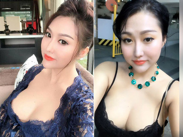 Đâu chỉ mỗi cằm nhọn Vline, sao nữ Vbiz còn thích thẩm mỹ bộ phận này