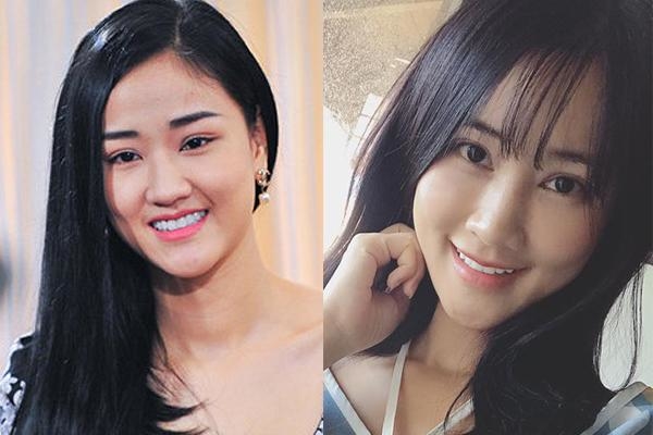 Đâu chỉ mỗi cằm nhọn Vline, sao nữ Vbiz còn thích thẩm mỹ bộ phận này