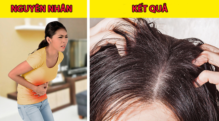 8 dấu hiệu cảnh báo sức khỏe đang có vấn đề thông qua mái tóc