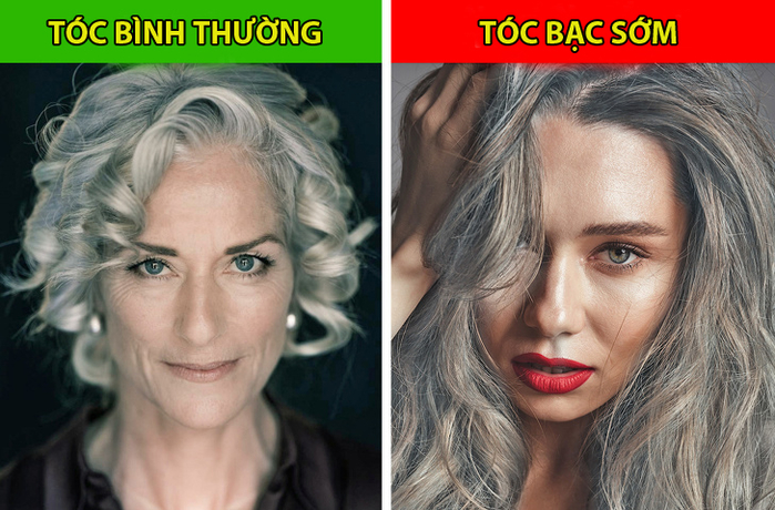 8 dấu hiệu cảnh báo sức khỏe đang có vấn đề thông qua mái tóc