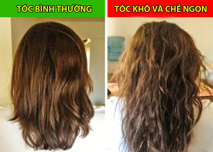 8 dấu hiệu cảnh báo sức khỏe đang có vấn đề thông qua mái tóc