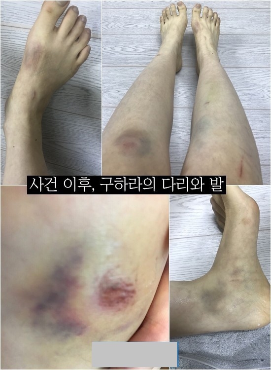 Bi kịch thần tượng Kpop thế hệ 9x: Người trầm cảm, người sa cơ
