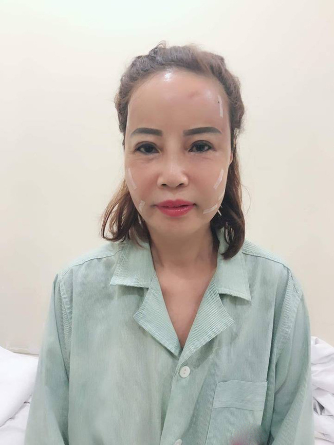 Chồng 26 nạm kim cương vào răng cho vợ 62 tuổi nhân ngày 20/10