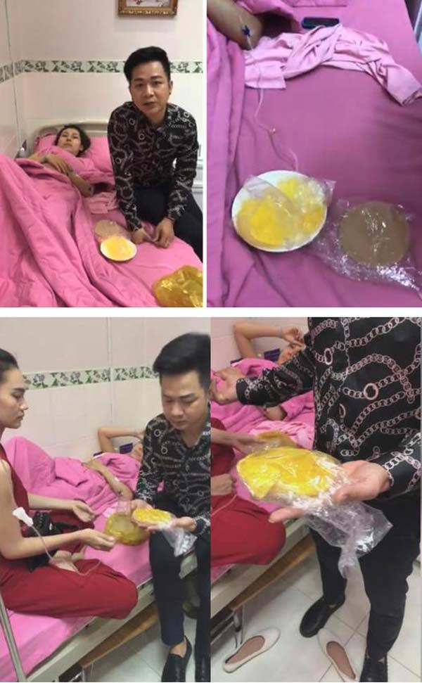 Khi sao Viet lam dep bang silicon: Nguoi no nguc don, ke hoai tu mui