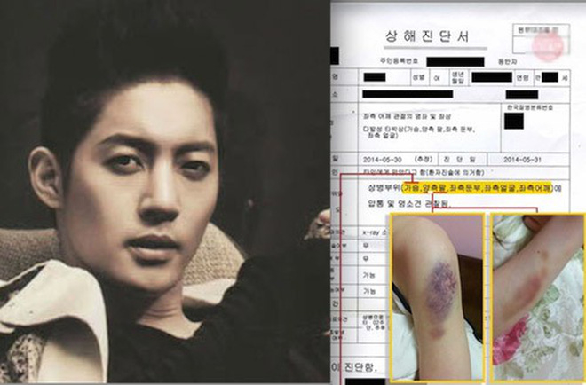 Kim Hyun Joong thang kien ban gai cu ho choi: Cuoc doi cua mot than tuong con lai gi
