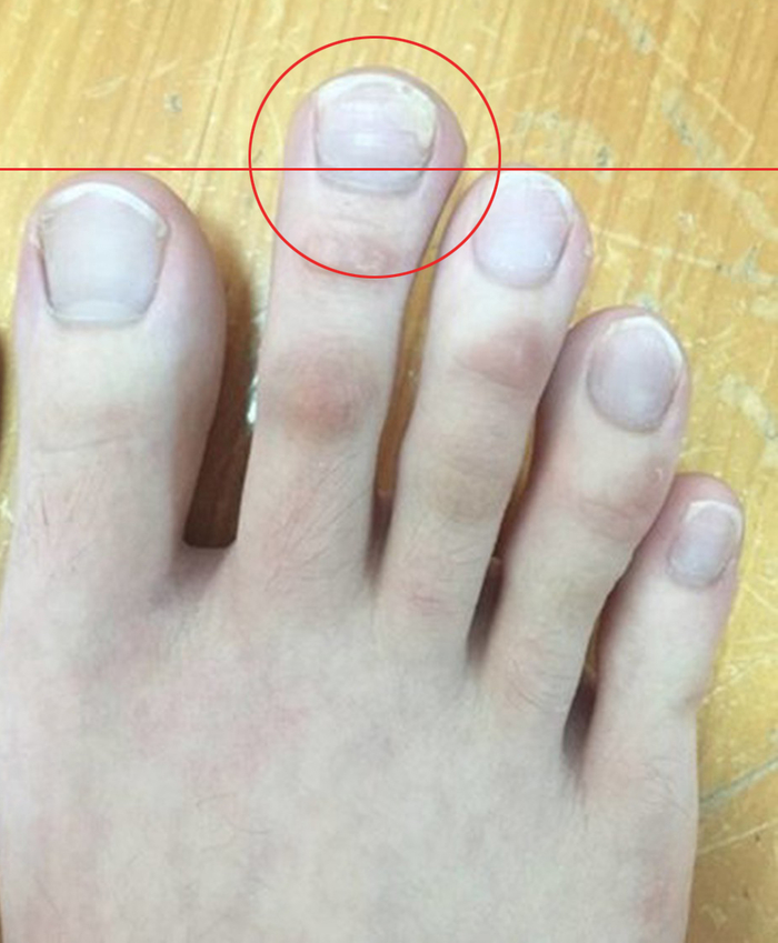 Nàng nào sở hữu tướng chân này thì mỗi bước đi là một bước tài lộc đến