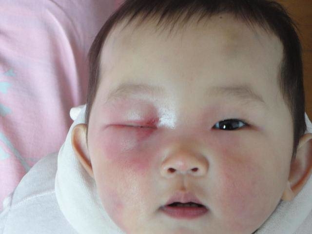 Nghe hàng xóm, bà nội lén con dâu cắt lông mi cho cháu để rồi hối hận