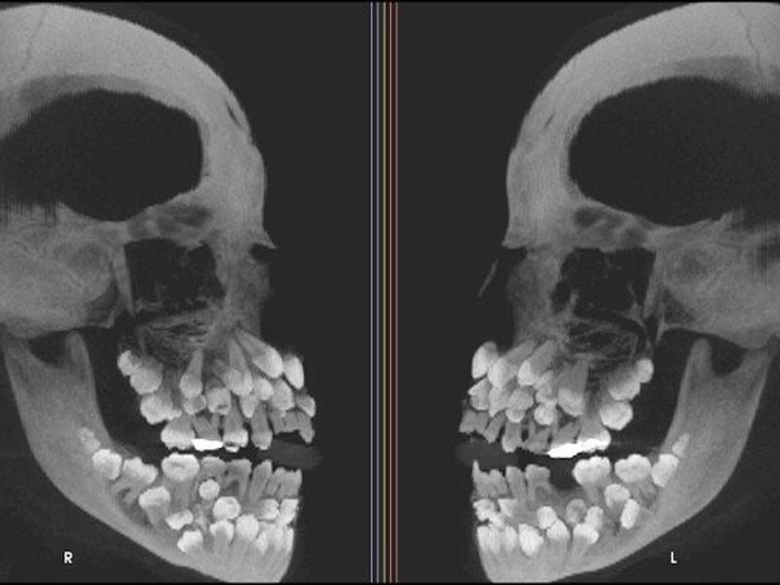 Những sự thật nằm sau tấm ảnh X-quang khiến bạn không khỏi ngỡ ngàng
