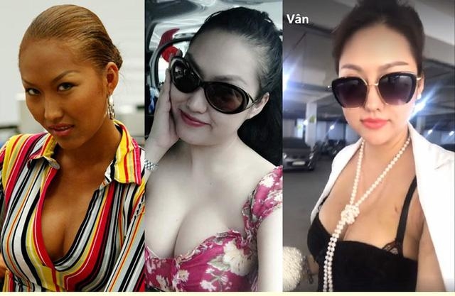 Đâu chỉ mỗi cằm nhọn Vline, sao nữ Vbiz còn thích thẩm mỹ bộ phận này