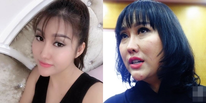 Soc voi khuon mat meo mo duoc cho la bien dang do tham my cua nhieu nguoi noi tieng