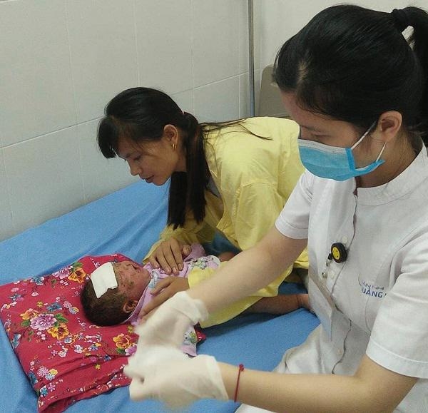 Thói quen tắm lá cho trẻ, một em bé nhập viện trong nguy kịch
