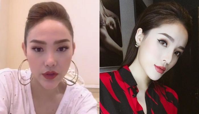 Đâu chỉ mỗi cằm nhọn Vline, sao nữ Vbiz còn thích thẩm mỹ bộ phận này