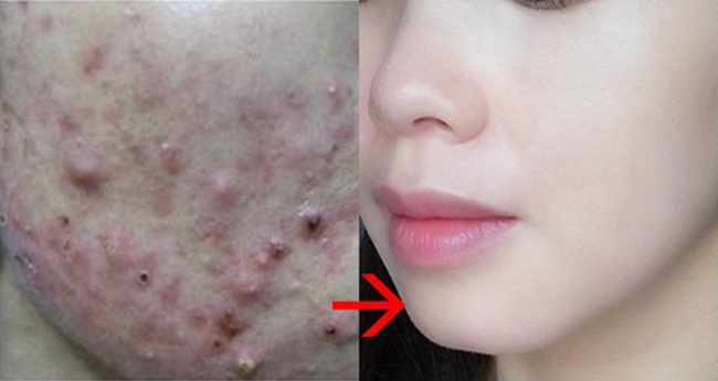 Trộn chanh với kem đánh răng - mẹo làm đẹp toàn diện cho bạn gái