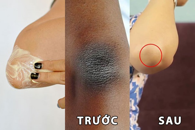 Trộn chanh với kem đánh răng - mẹo làm đẹp toàn diện cho bạn gái