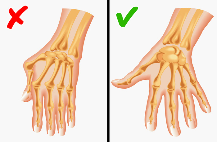 10 căn bệnh có nguy cơ cao sẽ di truyền cao từ mẹ sang con gái