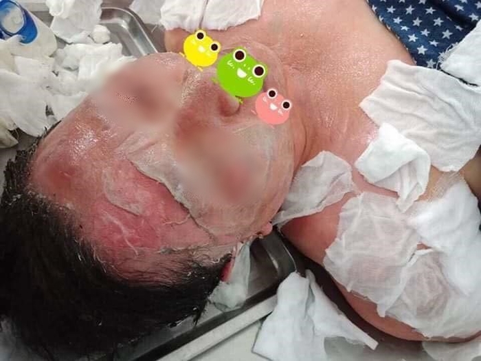 Phương pháp làm đẹp kinh hoàng với cồn nhân sâm khiến CĐM xôn xao
