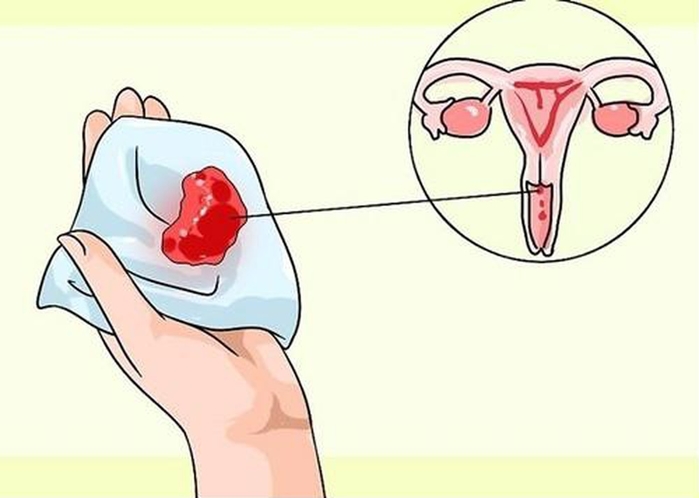 Con gái nên cẩn thận nếu gặp 5 dấu hiệu bất thường này vào ngày đèn đỏ