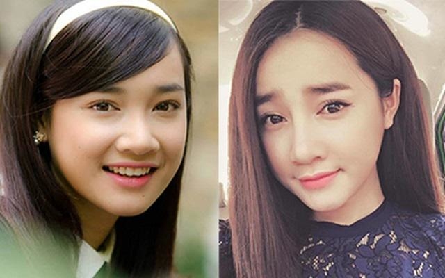 Mỹ nhân Việt “dao kéo” cải thiện nhan sắc: Không phải ai cũng suôn sẻ