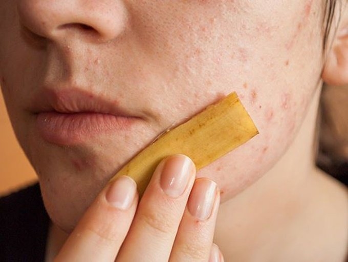 Khoan hãy vứt bỏ những quả chuối chín với 15 mẹo nhỏ sau đây