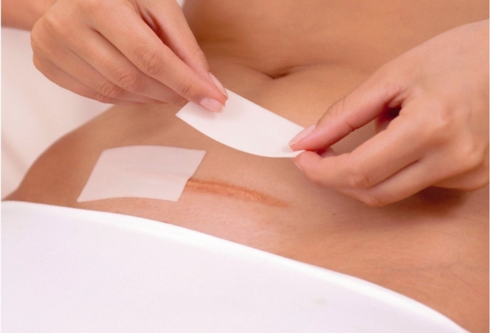 Lời khuyên giúp các bà mẹ mới sinh mổ phục hồi nhanh hơn
