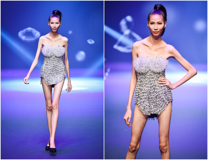 Mỹ nhân châu Á sở hữu đôi chân gầy đến dị dạng