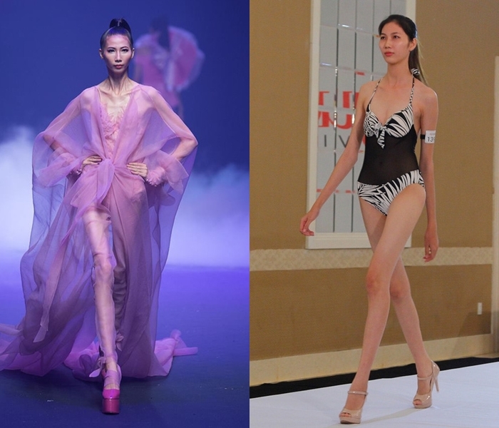 Mỹ nhân châu Á sở hữu đôi chân gầy đến dị dạng