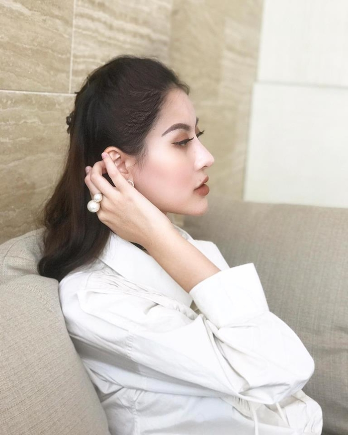 Netizen dụi mắt đến 3 lần mới dám tin đấy là Hà Lade sau ca phẫu thuật