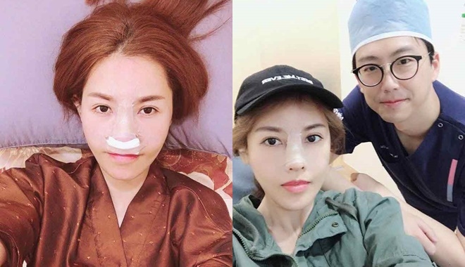 Mỹ nhân Việt “dao kéo” cải thiện nhan sắc: Không phải ai cũng suôn sẻ