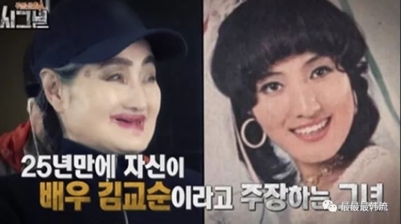 Sau anh hao quang: nguoi song chung voi 4 tan rac, nguoi that bai hoan toan