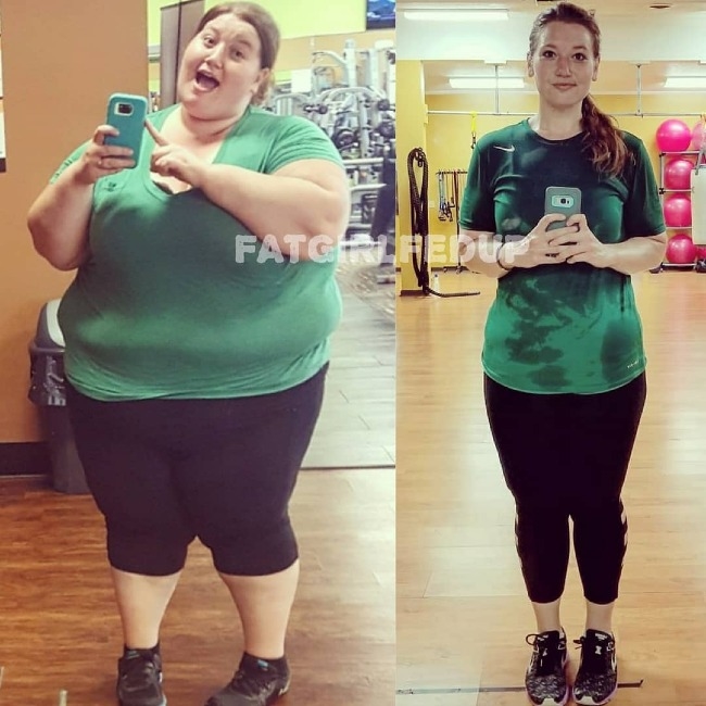 Sau nỗ lực giảm gần 150 kg, cô gái gây sốc với hình ảnh cơ thể chảy xệ