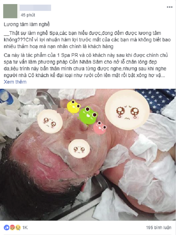 Su that phuong phap lam dep bang lua con: Co nguy hiem nhu moi nguoi van nghi