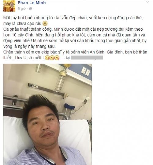 Tai nạn nghiêm trọng của sao Việt: Gãy xương, biến dạng khuôn mặt