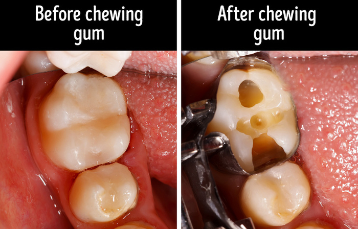13 thói quen xấu mà chúng ta vẫn hay lầm tưởng là vô hại