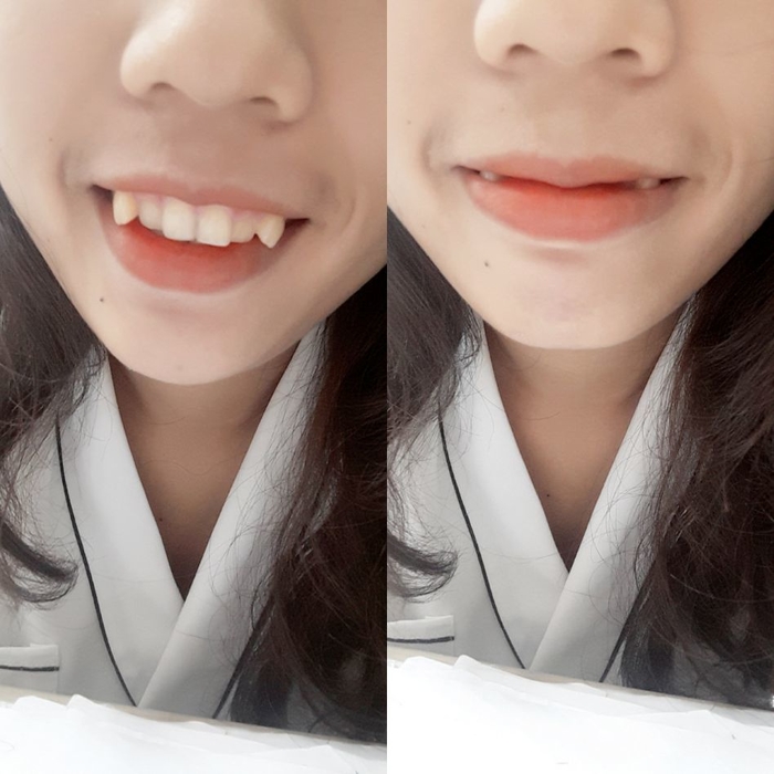 6 nét tướng mặt phụ nữ độc ác, nham hiểm chớ nên kết giao bạn bè