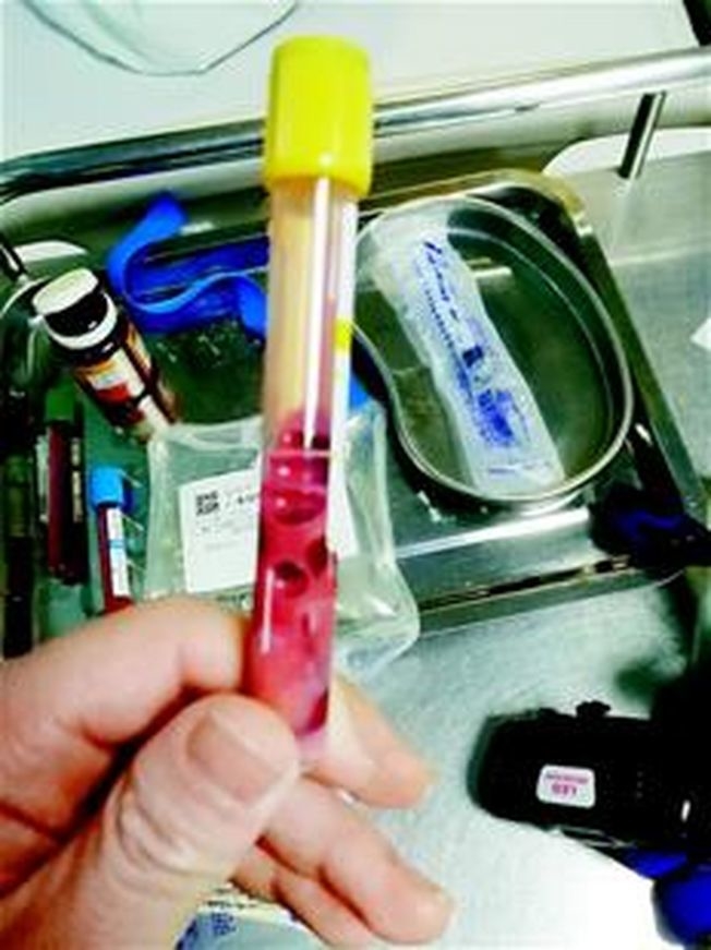 Cô gái 17 tuổi có máu biến thành màu hồng nhạt nhiều cha mẹ giật mình