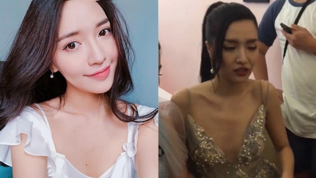 Huong Giang va loat nguoi noi tieng bi bien dang nhan sac do qua gay?