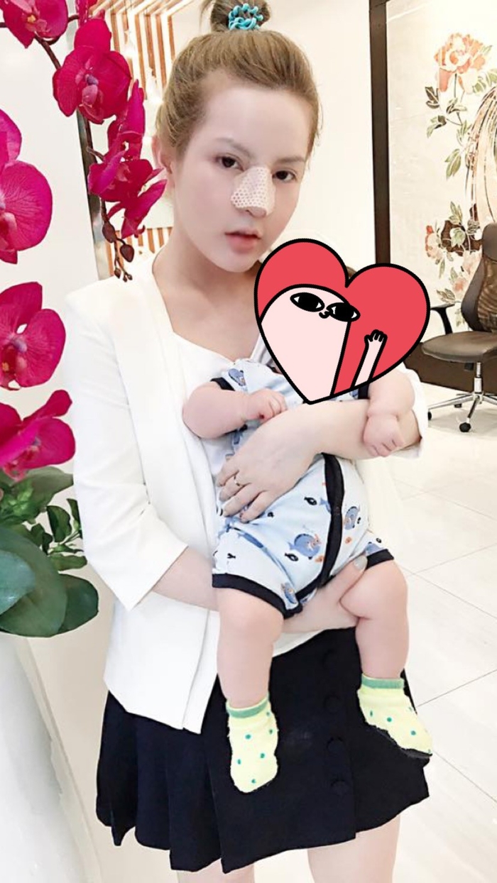 Hot girl dao kéo Vân Tokyo gây tranh cãi vì cứ đẻ xong lại PTTM