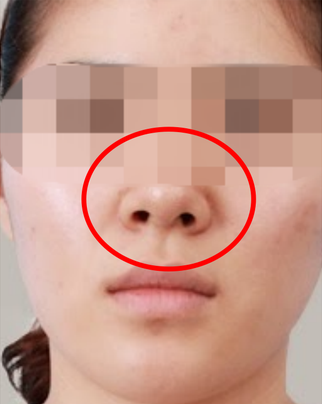 Những nét tướng xấu mang đến vận số khó khăn, ít người dám kết giao