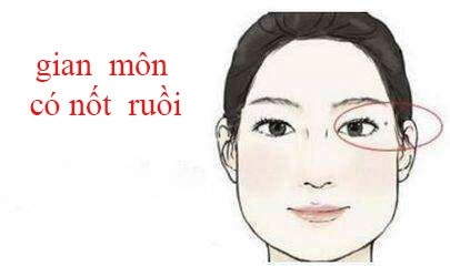 Những nét tướng xấu mang đến vận số khó khăn, ít người dám kết giao